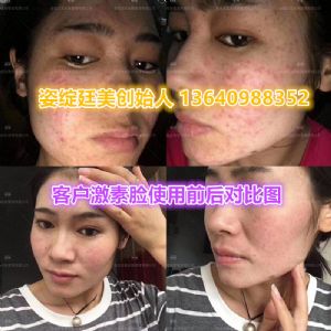 ��֪�������ҩ��ĤЧ����ô������������*ȴ������