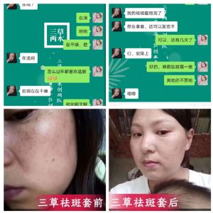 ��������ʦ����������ľ���˪������������ľ���˪����Ч����ô����