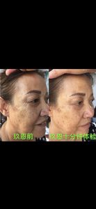 ��������ʯ���ഺ����Һ������