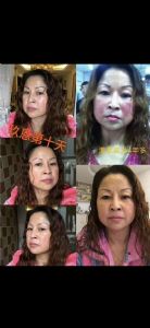 ��������ʯ���ഺ����Һ����ܵ�������������ô����