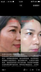 ������ױƷ���Ѫ˿�����Ч��������������Ʒ