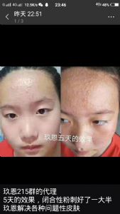 ��������ʯ���ഺ����ҺР����ô��Р����ʹ��