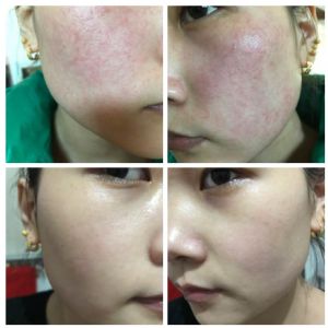 ������ľ����ˮ���Ѫ˿��Ч����ô����