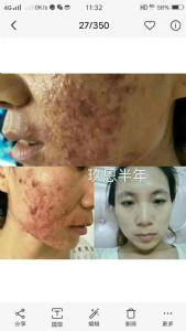 ��������ʯ���ഺ����Һ���