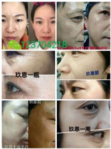 ȥ��ר�Ҿ�������ʯ���ഺ����Һ�����泧����������