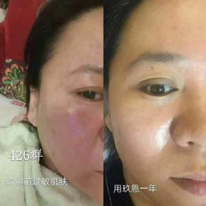 ���������м������þ�������ʯ���ഺ����Һ��˲�Ʒ��������