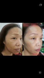 ��������ʯ���ഺ����Р��Ч����ô����ȫ��