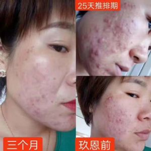 ���Լ۱ȸߡ���������ʯ���ഺ����Һ�����������𣬴����۸������