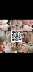 �󷲼��Ŷ�ƷMALL�̳Ǿ�������ʯ���ഺ����Һ�Ŀ�˥Ч����ô��