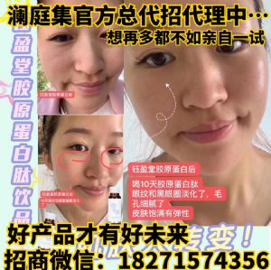 ͥԭļ۸񣿴ģʽô룿һƿ