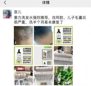 �ѷ�ͷƤ������ͷм�����ý���ϴ����